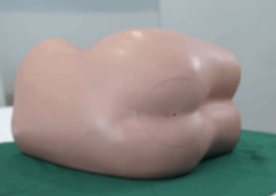 TYE1588.1 – Manequim de Endoscopia Baixa – Colonoscopia