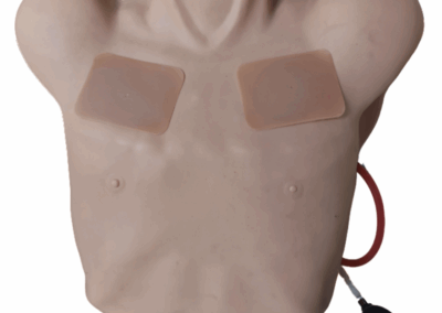 TYE1590 e TYE1554.1 – Pneumotórax e Drenagem do Peito