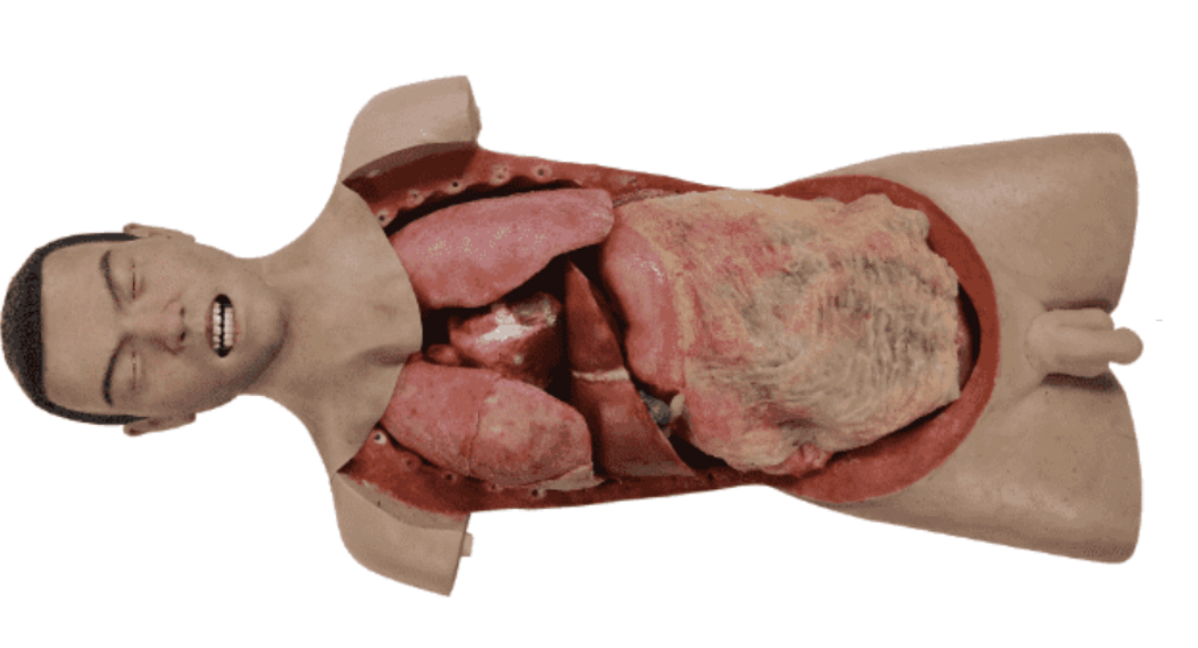 TYE9052 – Torso de Toracotomia – Cirurgia Aberta 